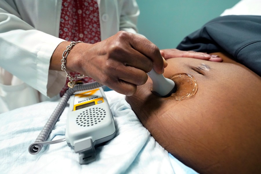 FILE - A doctor uses a hand-held Doppler probe on a pregnant woman to measure the heartbeat of the fetus on Dec. 17, 2021, in Jackson, Miss. U.S. births were flat in 2022, as the nation continues to see fewer babies born than before the pandemic. (AP Photo/Rogelio V. Solis, File)