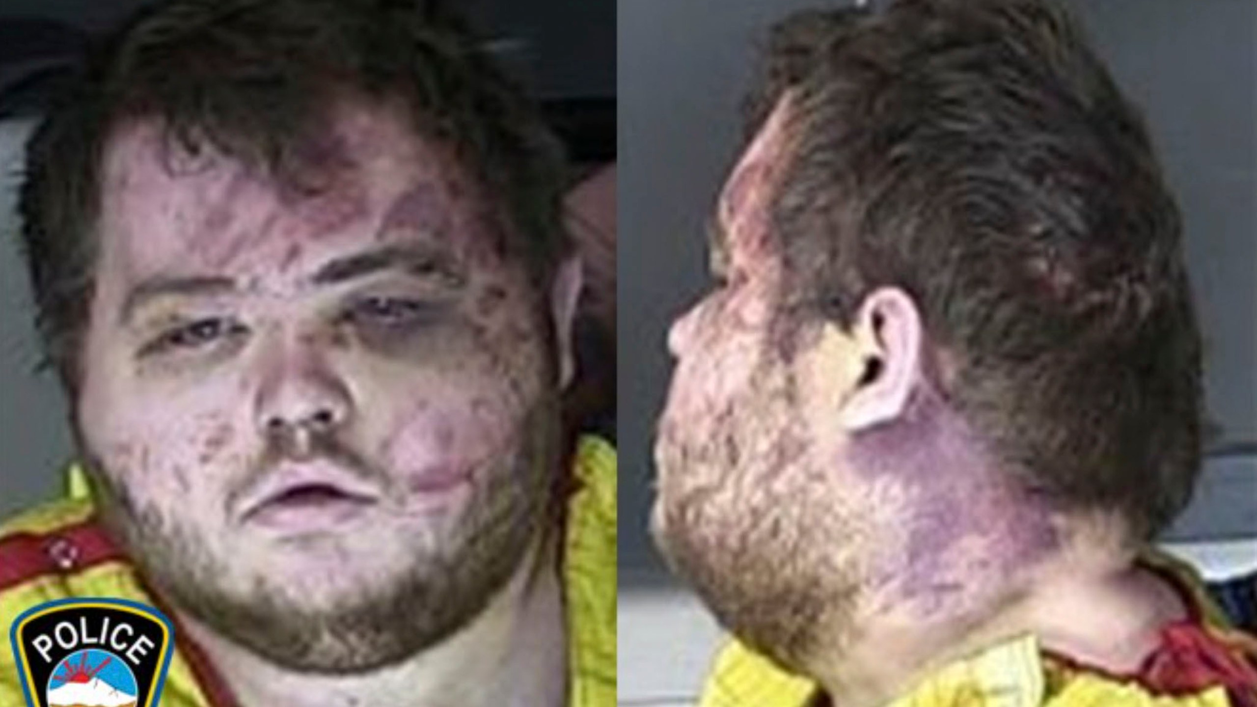 FILE - This booking photo provided by the Colorado Springs, Colo., Police Department shows Anderson Lee Aldrich, the suspect in a mass shooting that killed five people at a Colorado Springs LGBTQ+ nightclub last year, who pleaded guilty in the attack on Monday, June 26, 2023. (Colorado Springs Police Department via AP, File)