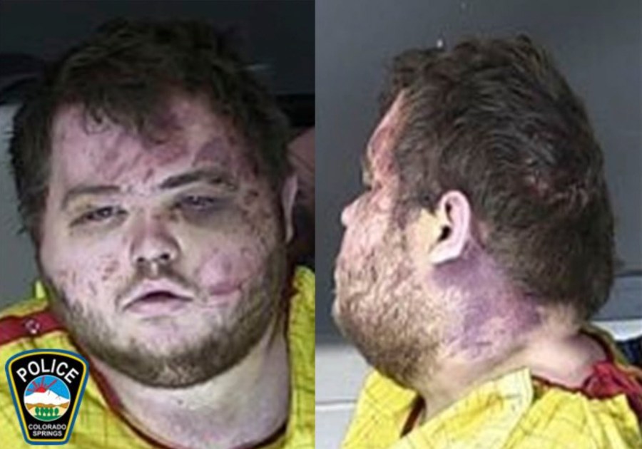 FILE - This booking photo provided by the Colorado Springs, Colo., Police Department shows Anderson Lee Aldrich, the suspect in a mass shooting that killed five people at a Colorado Springs LGBTQ+ nightclub last year, who pleaded guilty in the attack on Monday, June 26, 2023. (Colorado Springs Police Department via AP, File)