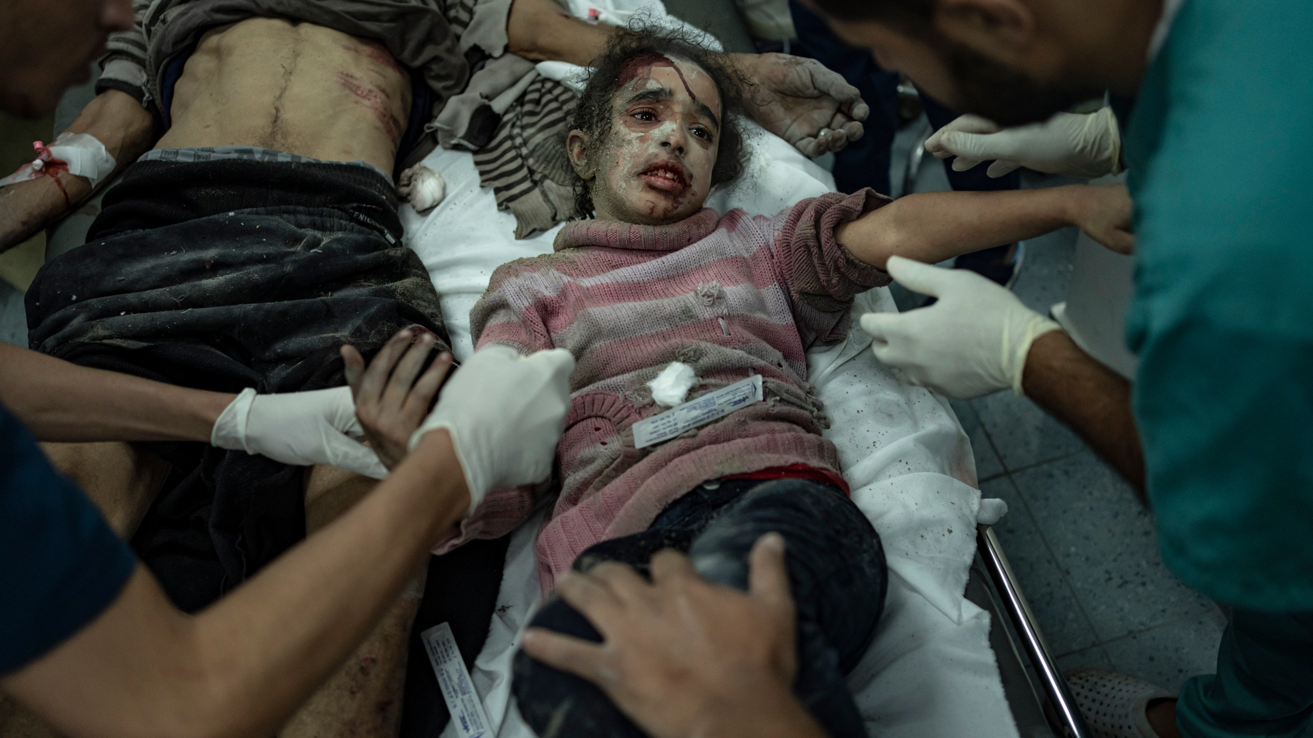 Palestinians wounded in the Israeli bombardment of the Gaza Strip arrive at a hospital in Rafah on Wednesday, Dec. 6, 2023. (AP Photo/Fatima Shbair)