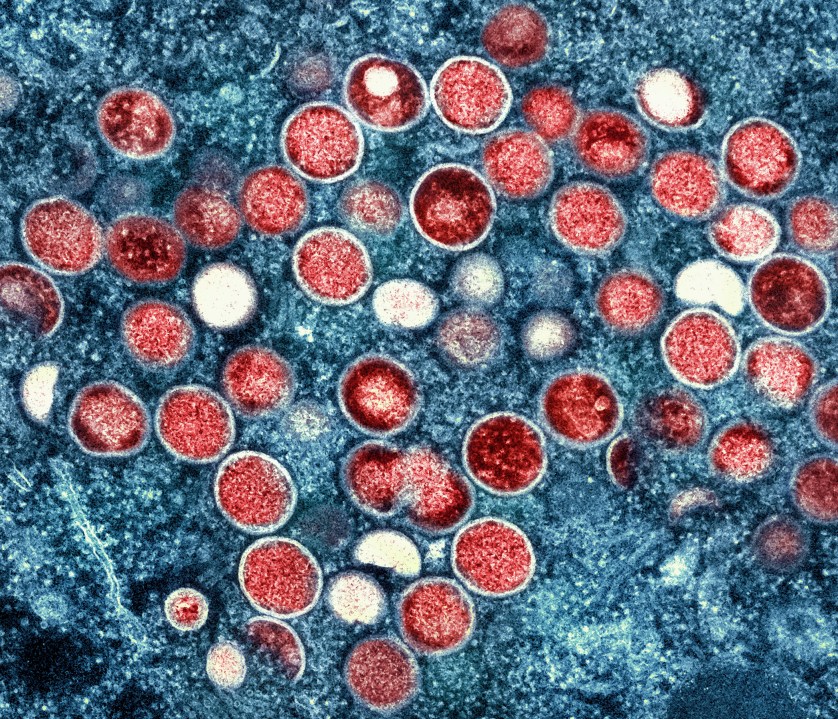 FILE - This image provided by the National Institute of Allergy and Infectious Diseases (NIAID) shows a colorized transmission electron micrograph of monkeypox particles (red) found within an infected cell (blue), cultured in the laboratory that was captured and color-enhanced at the NIAID Integrated Research Facility (IRF) in Fort Detrick, Md. Scientists say a new form of mpox detected in a mining town in Congo might more easily spread among people. Already, Congo is seeing its biggest mpox outbreak with more than 19,000 suspected infections and 900 deaths. (NIAID via AP, File)