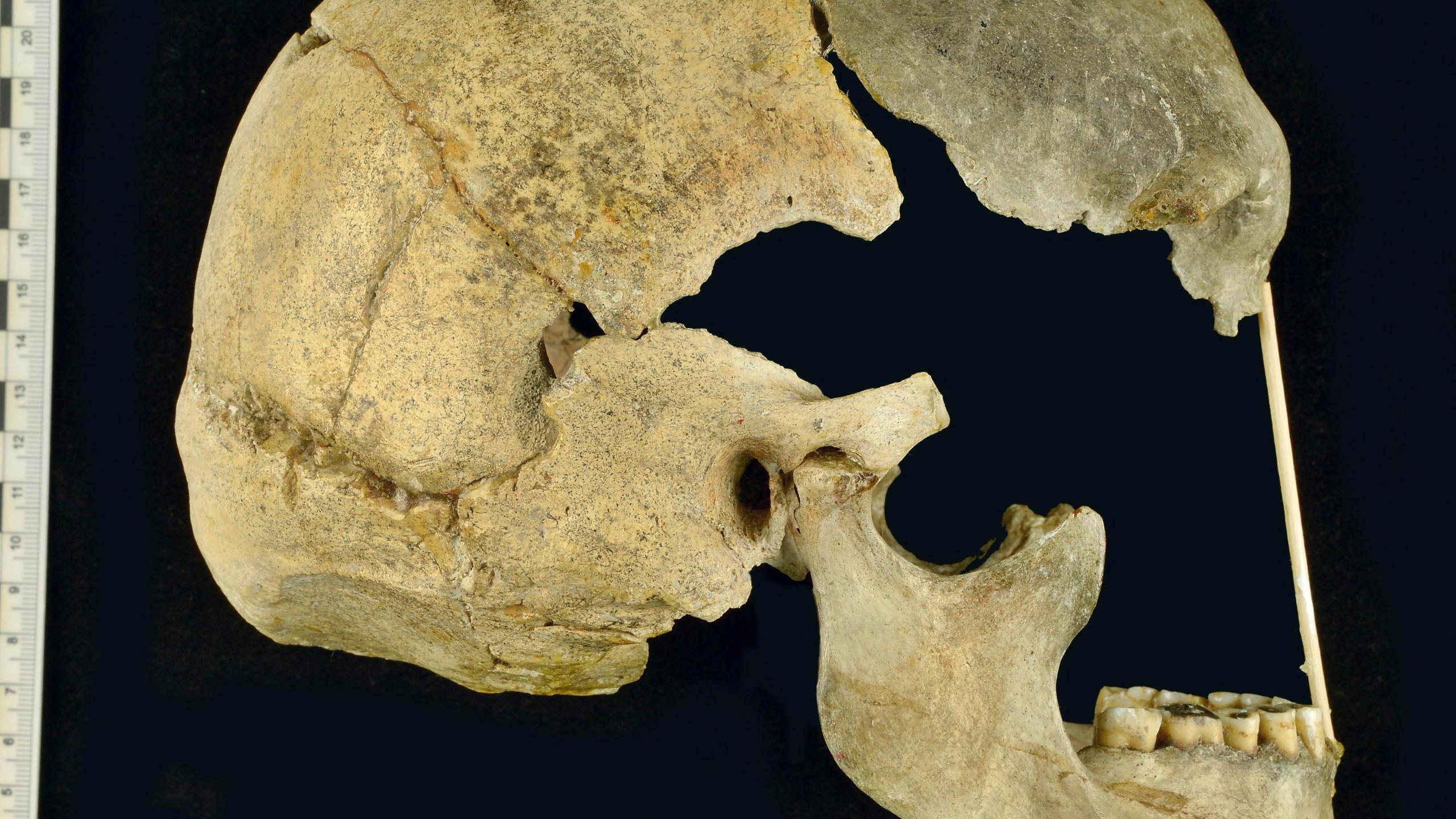 This image provided by National Museum, Prague shows the skull of an ancient human called Zlatý kůň, originally discovered in the Koněprusy caves of the Czech Republic. (Marek Jantač/National Museum, Prague via AP)