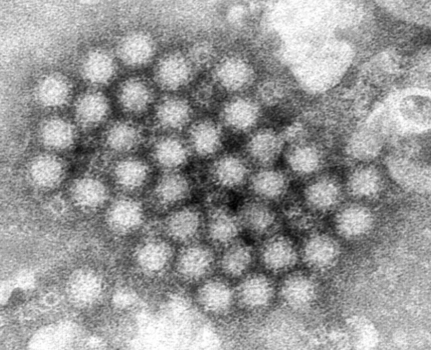 FILE - This electron microscope image provided by the Centers for Disease Control and Prevention shows a cluster of norovirus virions. (Charles D. Humphrey/CDC via AP, File)